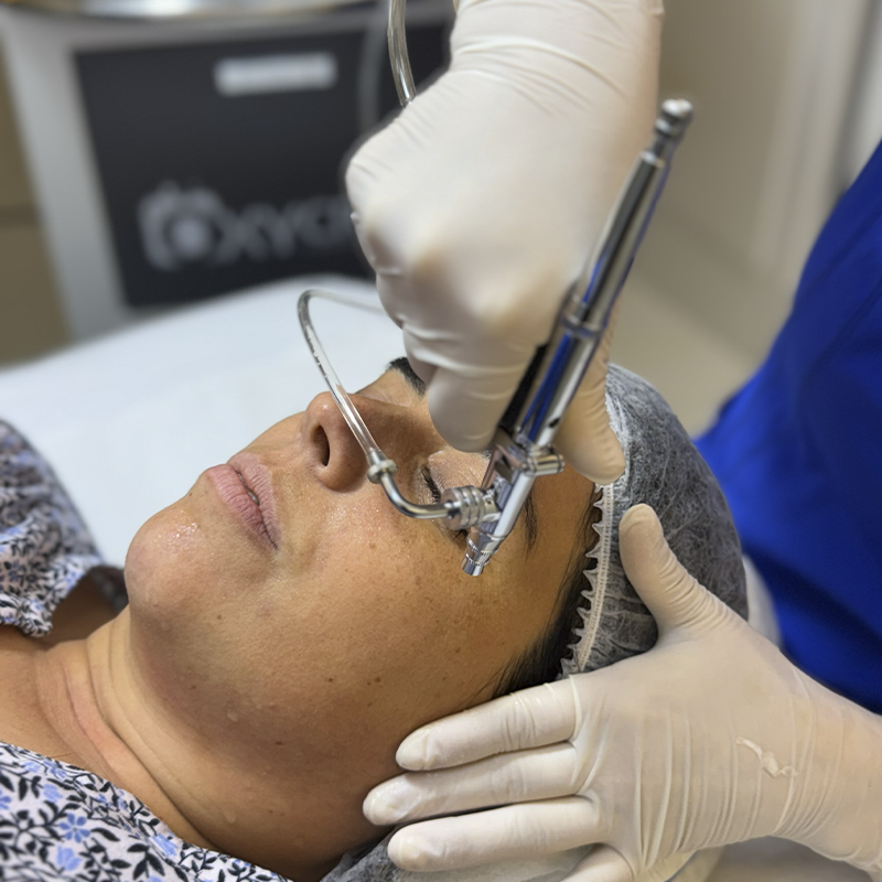 Tratamiento Oxycryo en Neosense
